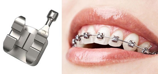 Metal Braket 3